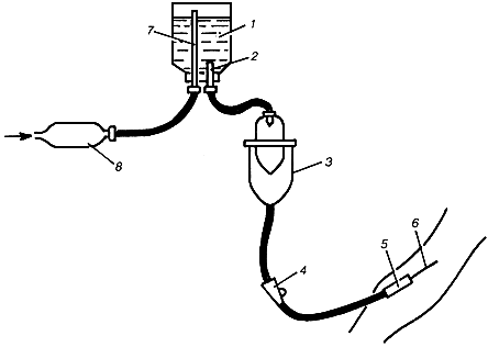 Капельницы для сосудов. Чертеж капельницы. Принцип действия капельницы. Система для внутривенных инъекций схема. Подача воздуха в капельнице.